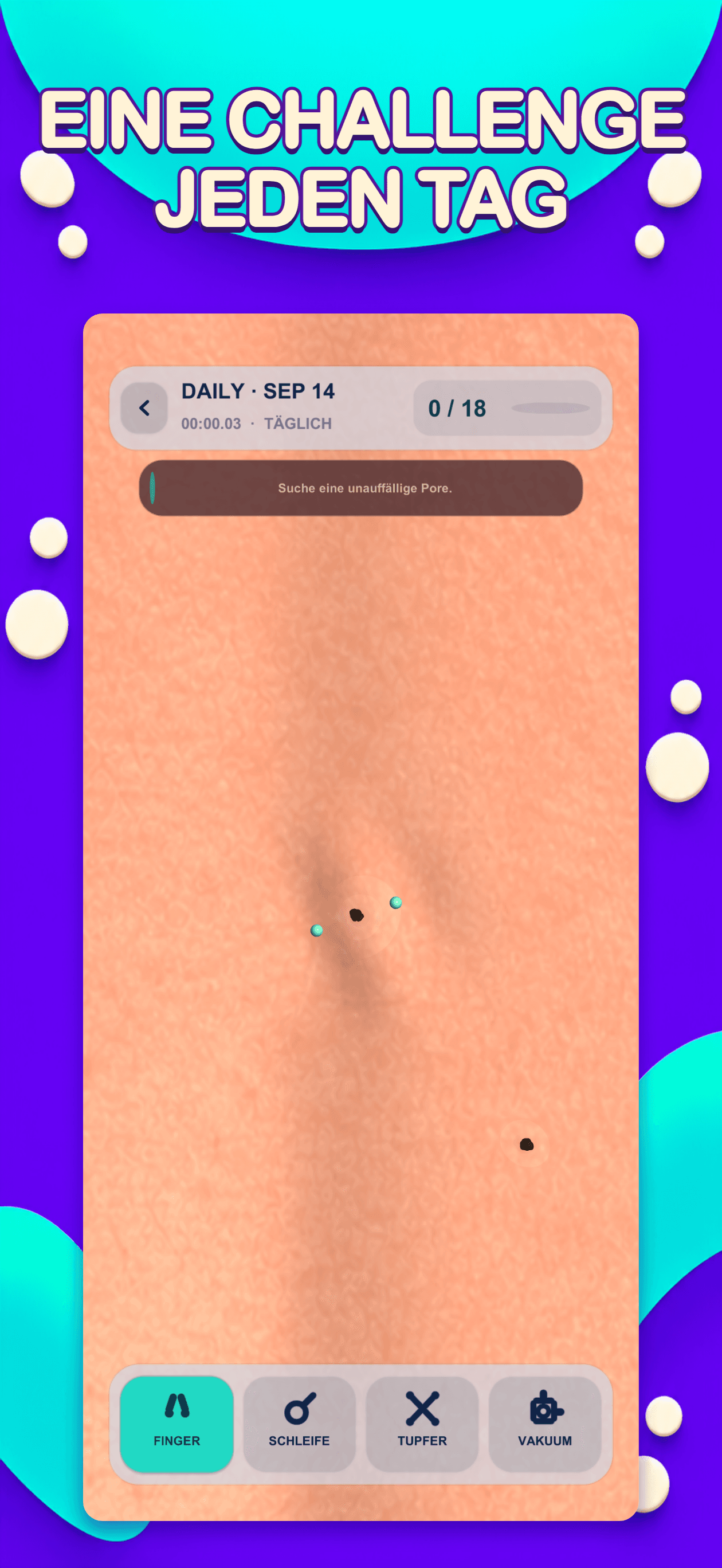 Project Pop: Pickel ausdrücken — Daily Challenge